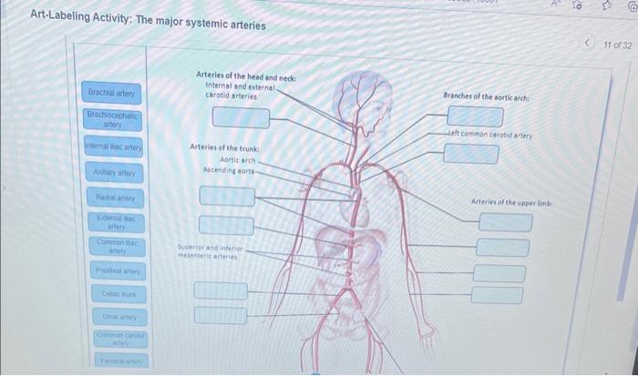 Art-labeling activity: the major systemic arteries