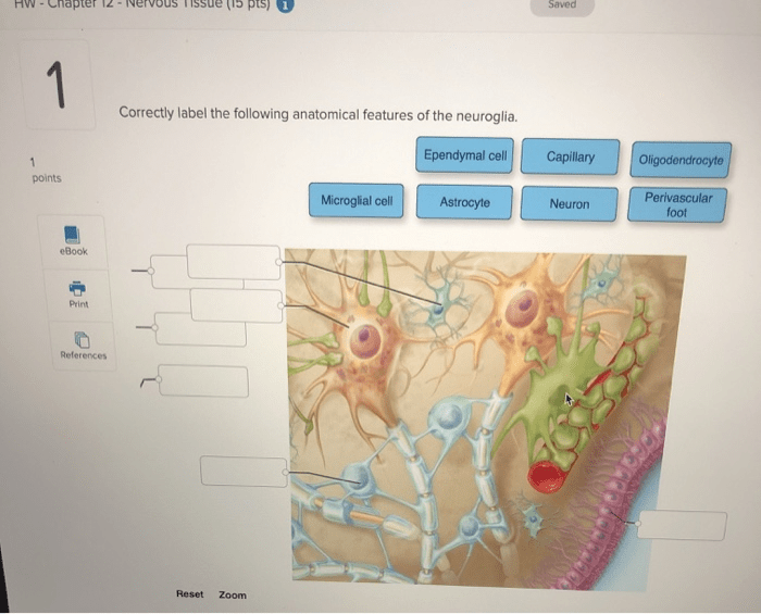 Correctly label anatomical features following neuroglia solved quiz lab system transcribed problem text been show has